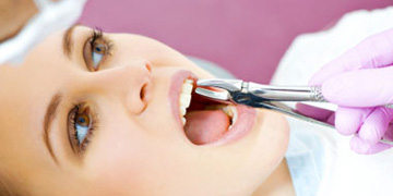 dental-extractions